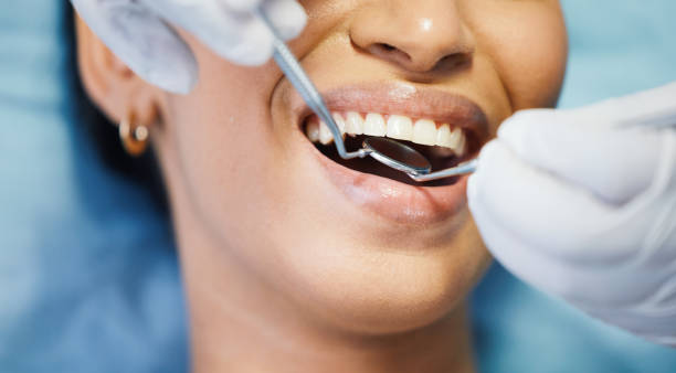 Best Emergency Wisdom Teeth Removal in Friend, NE