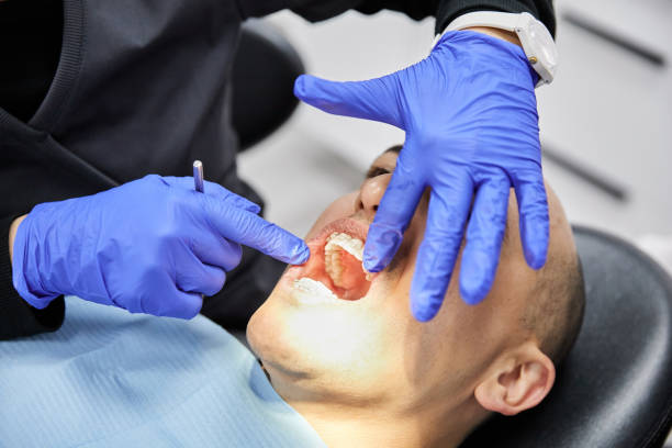 Best Emergency Broken Tooth Repair in Friend, NE